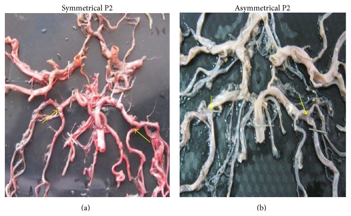 Figure 32