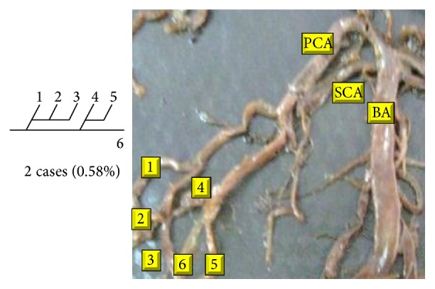 Figure 30