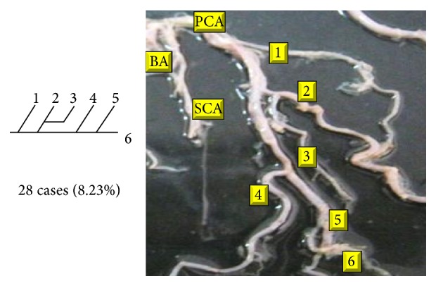 Figure 17