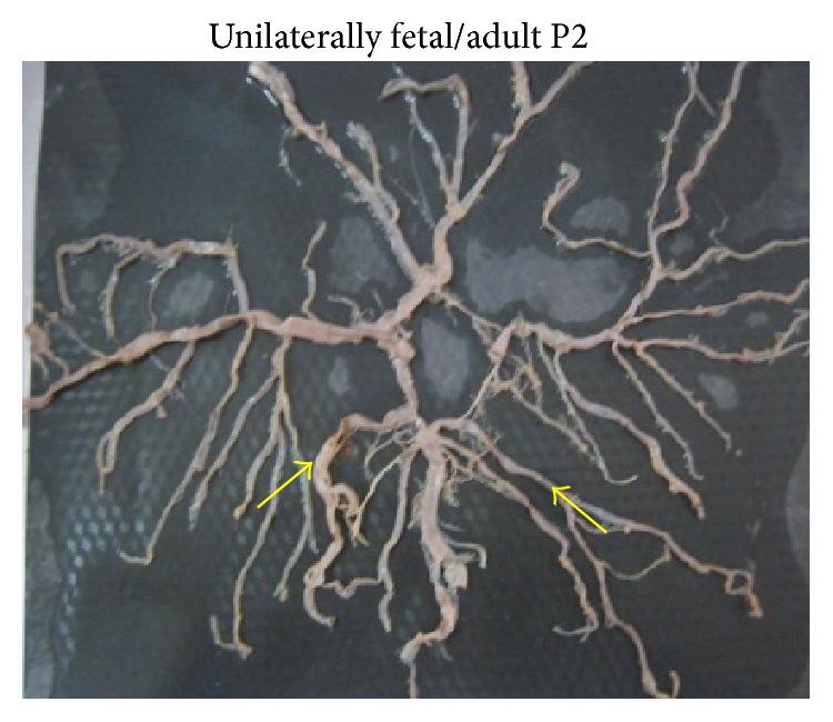 Figure 14