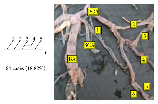 Figure 18