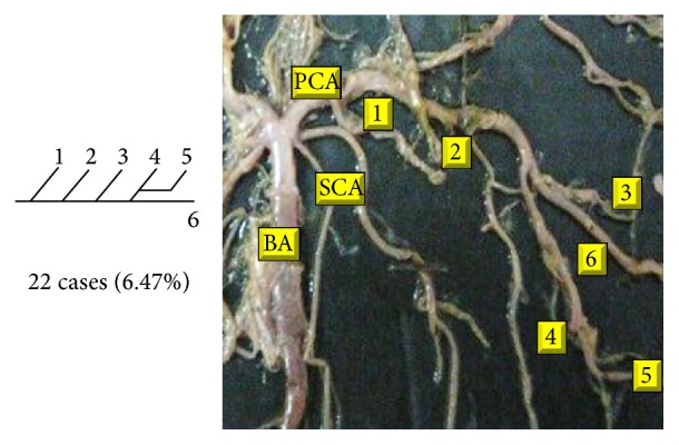 Figure 19