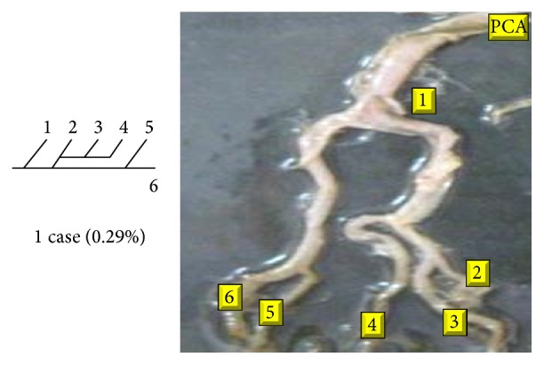 Figure 21