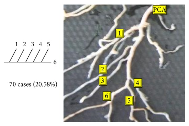 Figure 15