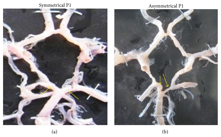 Figure 31