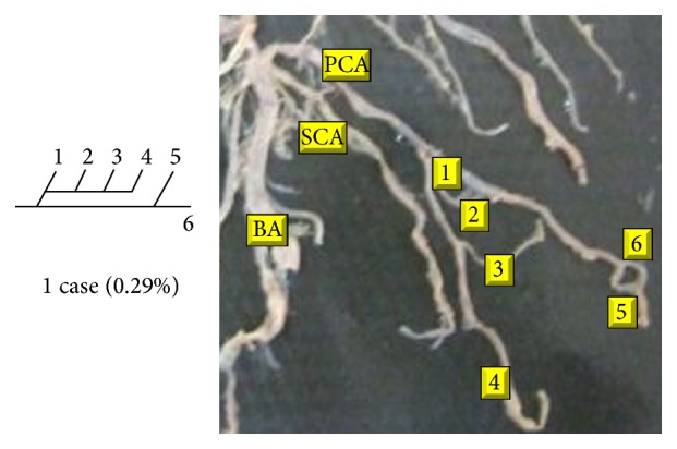 Figure 23