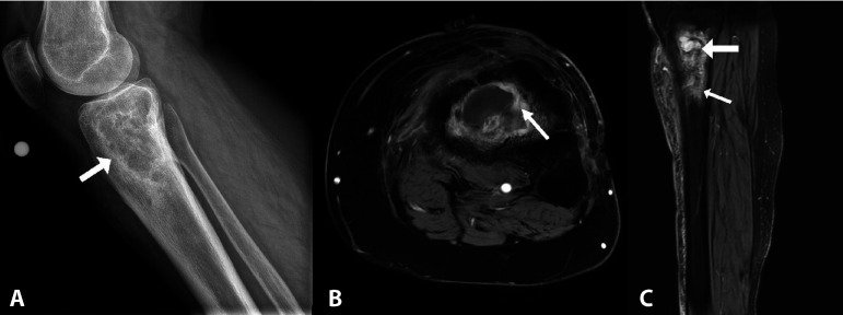 FIG 3