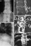 Fig. 13