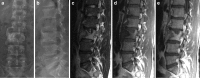 Fig. 20