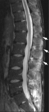 Fig. 21