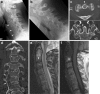 Fig. 19