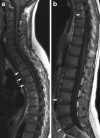 Fig. 17