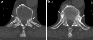 Fig. 15