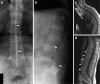 Fig. 12