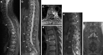 Fig. 16