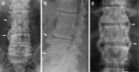 Fig. 18