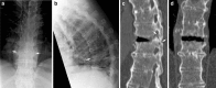 Fig. 14