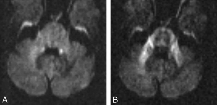 Fig 2.