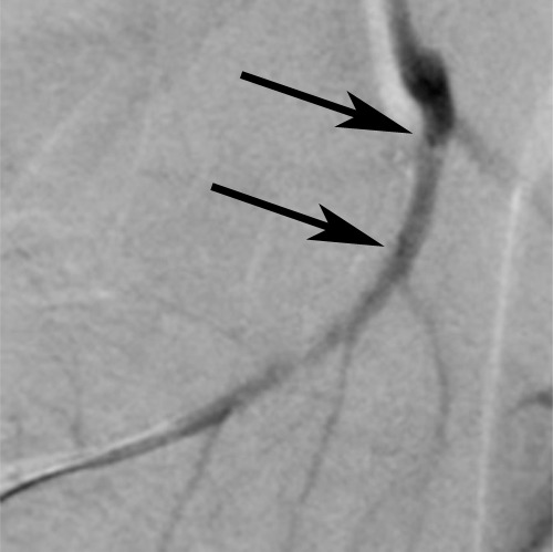 Figure 2a: