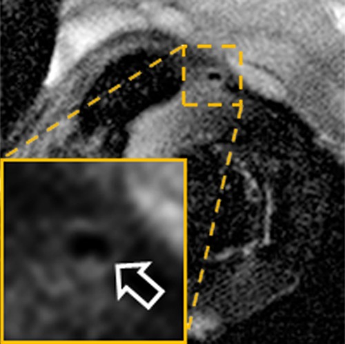 Figure 2c: