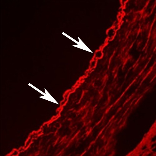 Figure 2f: