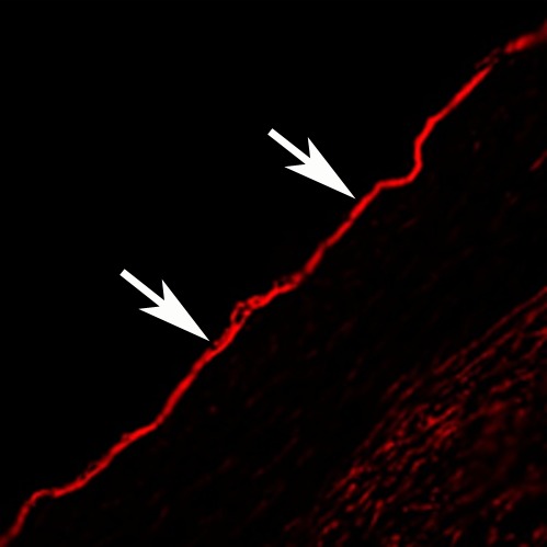 Figure 2h: