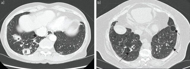 FIGURE 4