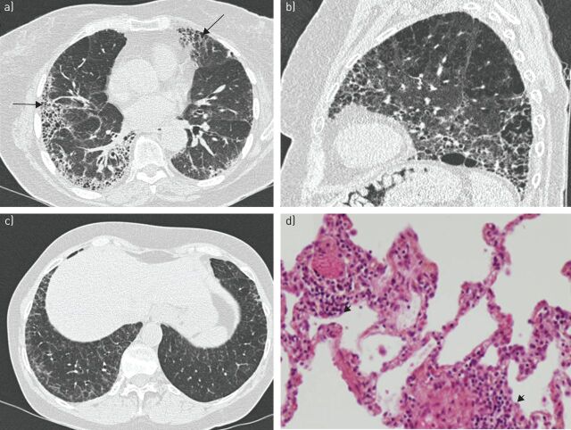 FIGURE 2