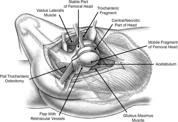 Fig. 1