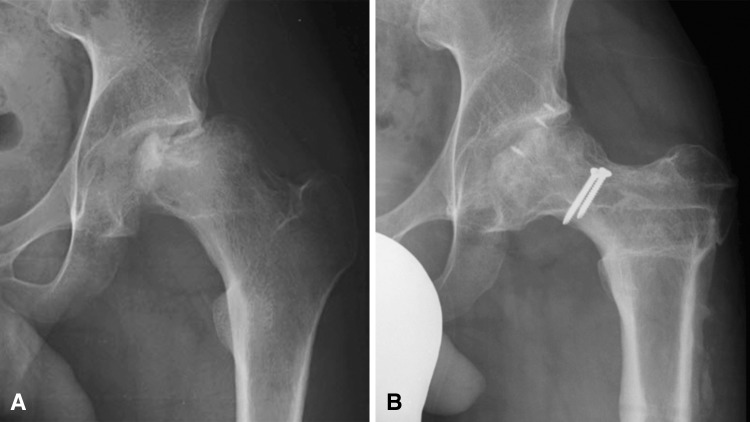 Fig. 5A–B