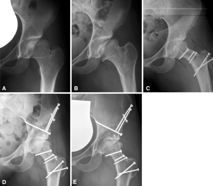 Fig. 4A–E