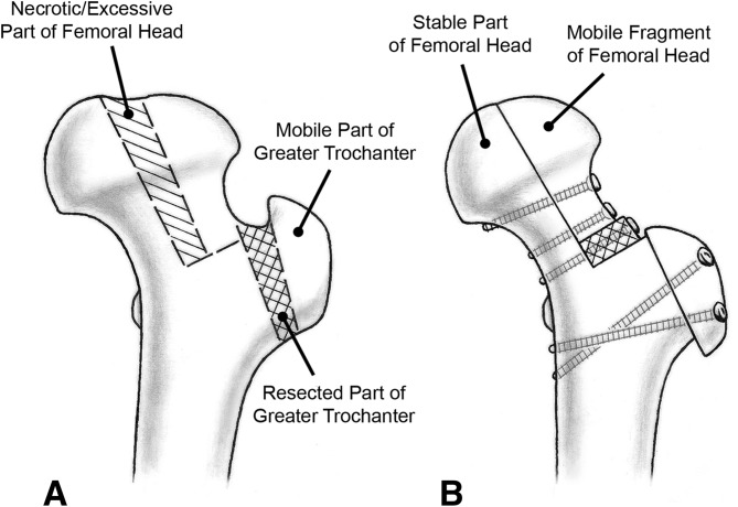 Fig. 2A–B