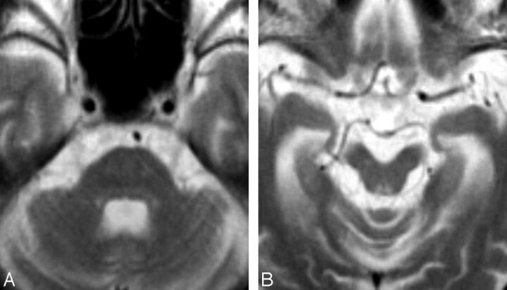 Fig 3.