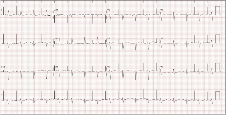 Fig. 3B