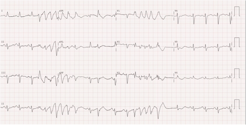 Fig. 3A