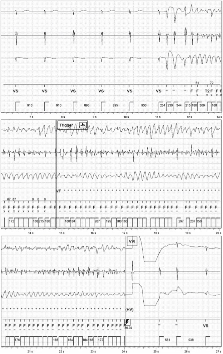 Fig. 2