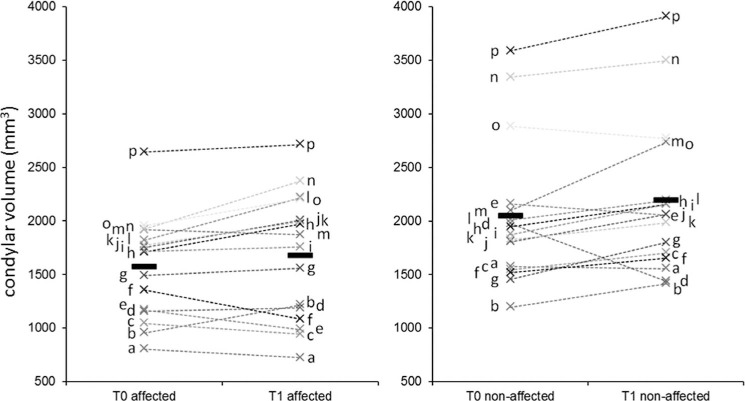 Figure 3. Condylar volume at T0 and T1 in the affected and nonaffected side (patients coded by letters). Please note the individual variability of the response of the condyles on both sides.