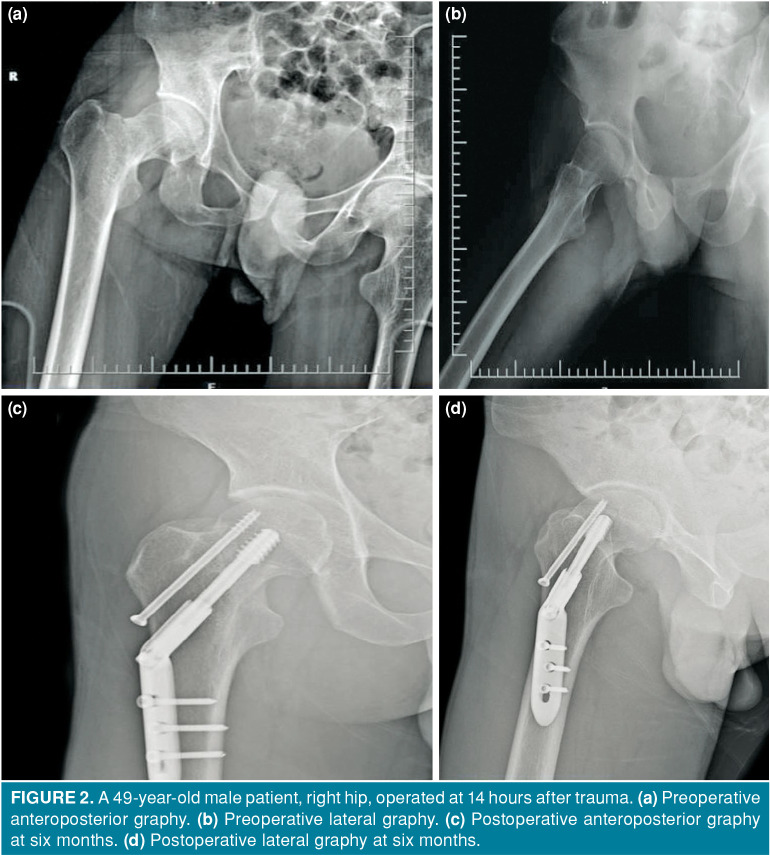 Figure 2