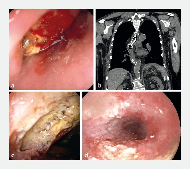 Fig. 2 a