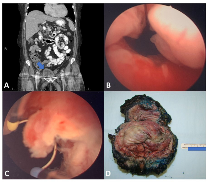 Fig. 1