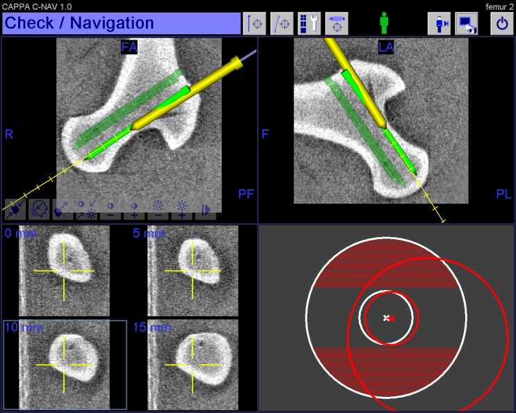 Fig. 3