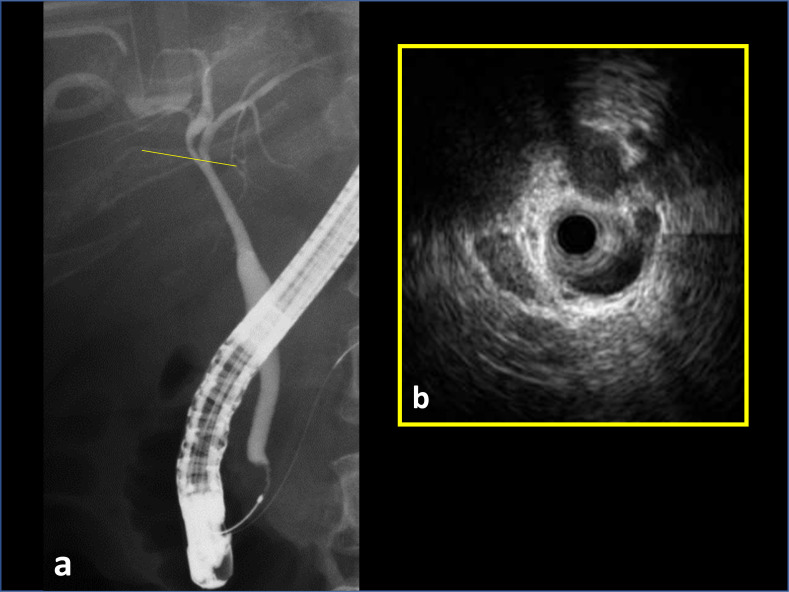 Fig. 3. a