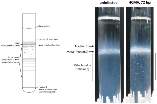 Figure 3.27.4