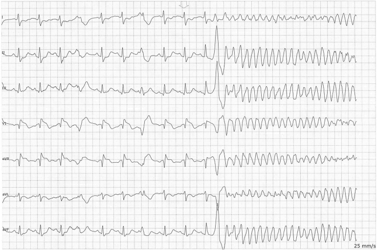 Figure 1