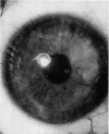 105