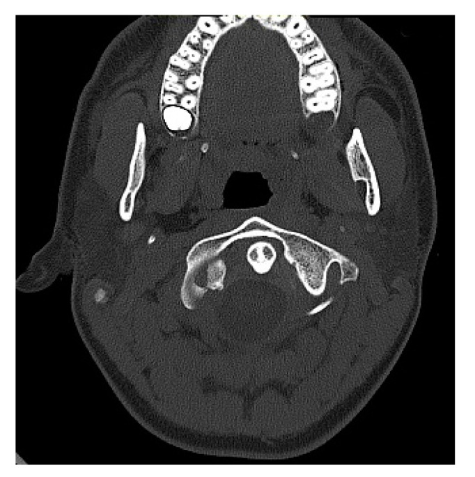 Figure 2