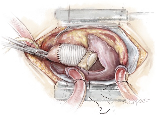 Figure 13