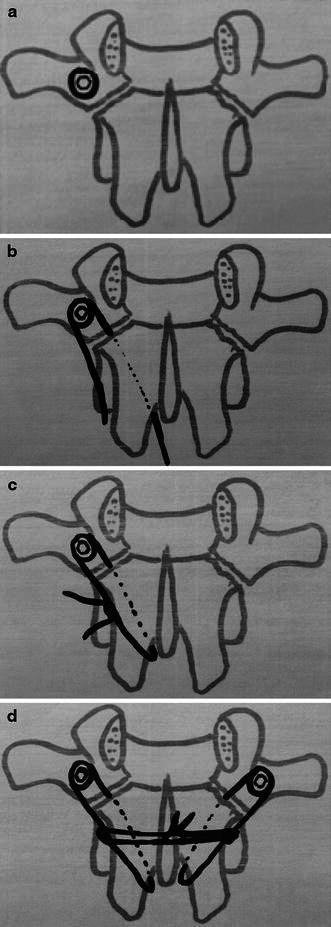 Fig. 4