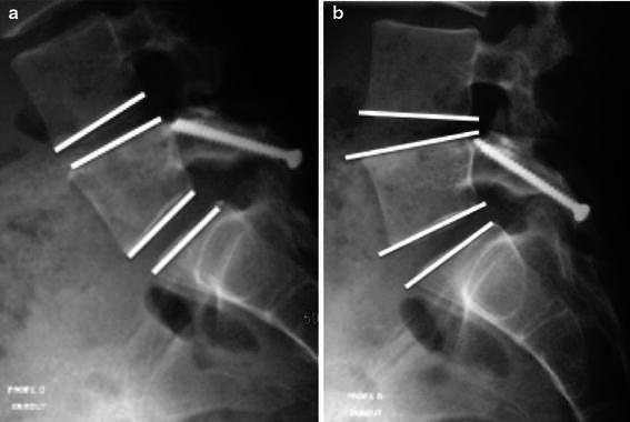 Fig. 1