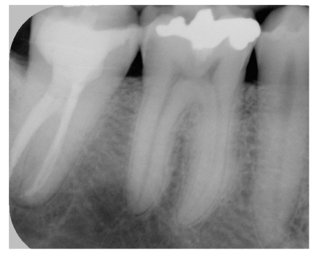 Fig. (5)